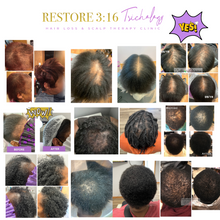 Load image into Gallery viewer, Scalp Restore Oil