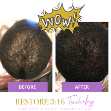 Load image into Gallery viewer, Scalp Restore Oil
