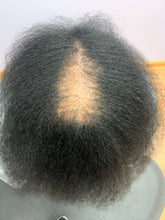 Load image into Gallery viewer, Scalp Restore Oil
